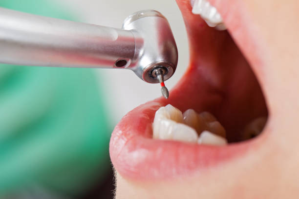 Best Emergency TMJ Treatment in Hazelwood, MO